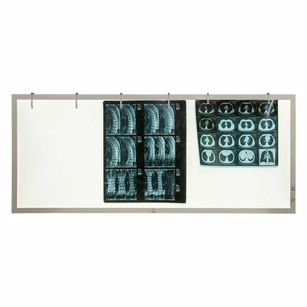 Негатоскоп TAGLER НСД-3 3-кадровый светодиодный